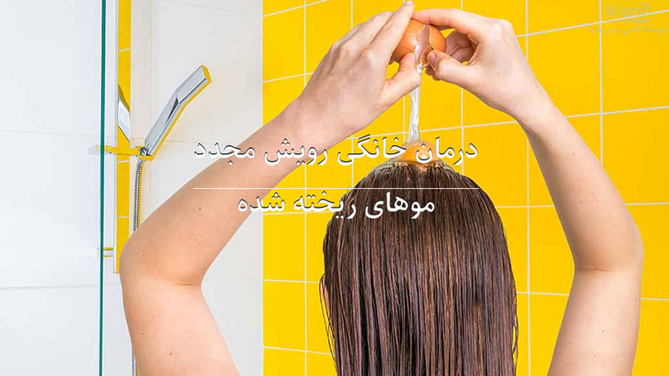درمان خانگی رویش مجدد موهای ریخته شده-merspharma